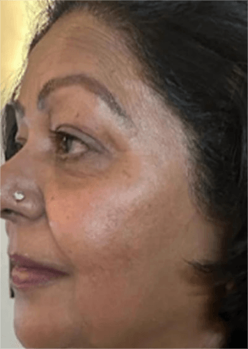 InstaLift Eye Cream photo review