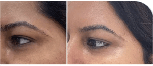 InstaLift Eye Cream photo review