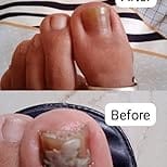 NailFixx Pro photo review