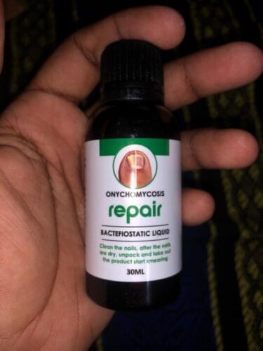 NailFixx Pro photo review