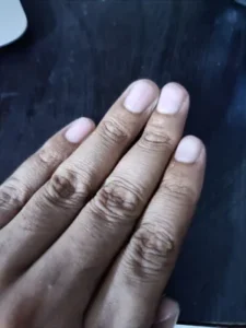 NailFixx Pro photo review